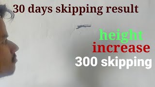 real result of 30 days 300 skipping  realistic one  height heightincreasetips [upl. by Balthasar]