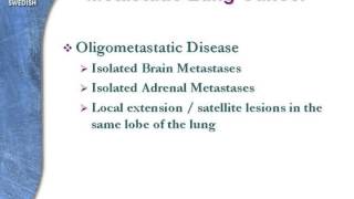 GRACEcast126RadRefining Radiation Therapy for Lung Cancer Part 6 Metastatic Lung Cancer [upl. by Ecirtemed721]