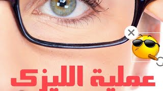 تجربتي مع الليزك لتصحيح النظر بعد مرور 4 سنوات وتكلفتها ورأيي فيها [upl. by Annehcu963]