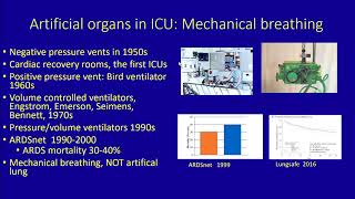 Extracorporeal Life Support in Critical Care [upl. by Sinnel]