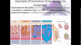 Pathophysiology 17 Cancer overview [upl. by Tala552]