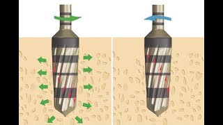 Osseodensification system in dental implant surgery [upl. by Riane]