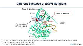 Testing for Common and Uncommon EGFR Mutations to Guide EGFRTargeted Therapy in NSCLC [upl. by Marlie836]