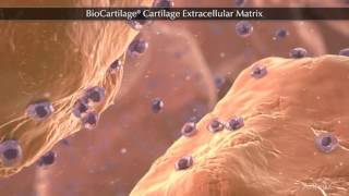 BioCartilage® Cartilage Extracellular Matrix [upl. by Sheena]