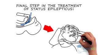 Neurology – Status Epilepticus By George Porfiris MD [upl. by Ikcir783]