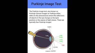 Purkinje image test or purkinje light reflex test in ophthalmology Optometry Fans [upl. by Kristianson]