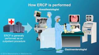 Understanding ERCP Endoscopic Retrograde Cholangiopancreatography [upl. by Shaughnessy]