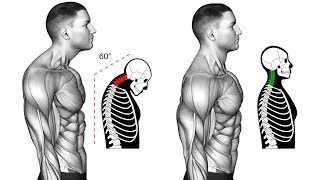 Improve My Posture in 14 Days Get Perfect Posture [upl. by Akahc]