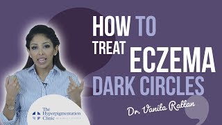 How to Treat Eczema Dark Circles for darker Skin Avoid Common Mistakes Made by Doctor Vanita Rattan [upl. by Yanej]