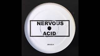 BOBBY KONDERS  NERVOUS ACID [upl. by Feeley772]