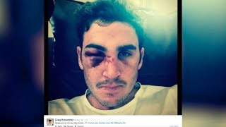 Former England cricketer Craig Kieswetter [upl. by Romilly]