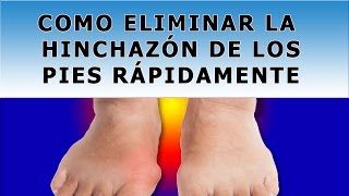 Metodos Naturales Para Quitar La Hinchazon De Los Pies [upl. by Sherourd]