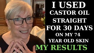 I USED CASTOR OIL FOR 30 DAYS ON MY 74YEAROLD SKIN  MY RESULTS [upl. by Etneciv]