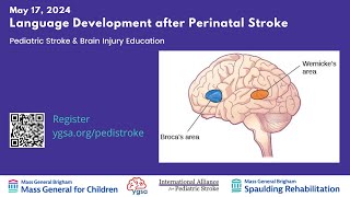 Language Development after Perinatal Stroke [upl. by Perr]