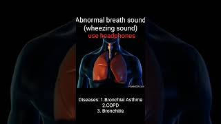 Wheezingabnormal breath soundAsthmaCOPDBronchitisHow to different wheezing soundMed school way [upl. by Eiramlirpa720]