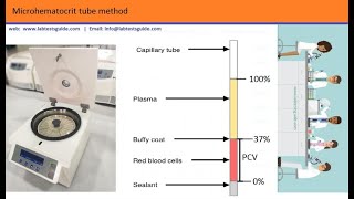 كيفية إجراء فحص ال Microhematocrit [upl. by Am]