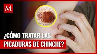 ¿Te picó una chinche Te decimos cómo tratar la picadura en casa [upl. by Nnayar]