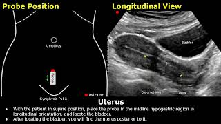 Gynecology Examination Part 1  Physical Speculum Vaginal Examination for Medical Students [upl. by Viviyan]