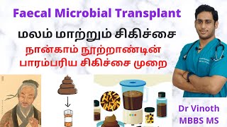 மலம் மாற்றும் சிகிச்சை  Fecal Microbiota Transplant  FMT  How FMT works   Fecal transplant [upl. by Lednahs]