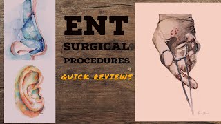 ENT SURGICAL PROCEDURES lecture 4 CORTICAL MASTOIDECTOMY with important points [upl. by Acina]