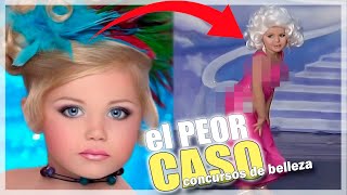 El PEOR CASO de los CONCURSOS de BELLEZA [upl. by Ynittirb473]