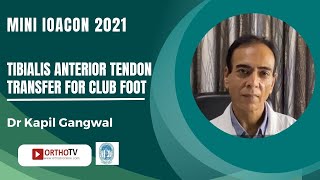 Tibialis Anterior Tendon Transfer for Club Foot  Dr Kapil Gangwal [upl. by Lajes]