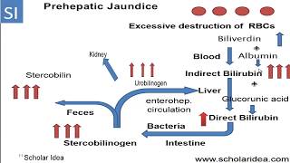 Prehepatic jaundice  الصفراء التحليلية [upl. by Nahshon253]