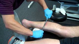 Graston Technique  Foot amp Plantar Fasciitis [upl. by Aimac]