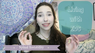 Living with EDS Spinal Instability [upl. by Amalee916]