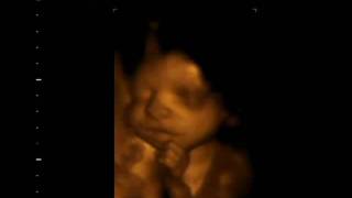 3D Ultrasound Session at 27 weeks amp 4 days [upl. by Shoshana915]