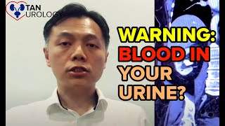 YOU Need To Know About Blood In The Urine  Spot The Warning Signs Early [upl. by Eatnoled]