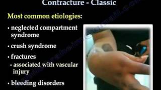 Volkmanns Ischemic Contracture Classic  Everything You Need To Know  Dr Nabil Ebraheim [upl. by Anaejer223]