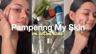 My Skincare Routine For Active Acne  How To Get Rid ofPimples Acne amp Blemishes skincareforacne [upl. by Hannus59]