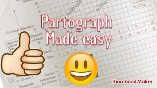 partograph made easy [upl. by Nnylarak]