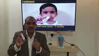 Otitis media with effusion Hindi Patient teaching programme [upl. by Kort]