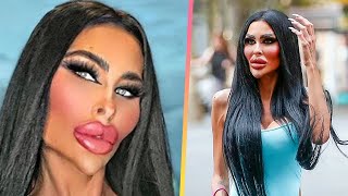 BOTCHED Plastic Surgery That Made Celebrities Unrecognizable  Marathon [upl. by Eppillihp]