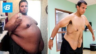 The Incredible Shrinking Man  Jesse Shand Lost 350 Pounds [upl. by Airdnala]