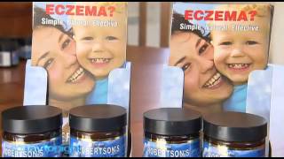 Eczema Ointment Today Tonight Adelaide [upl. by Harding]