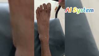 Surface marking of Dorsalis Pedis Artery  1st Prof MBBS Examination  MH Samorita Medical College [upl. by Alleyne]