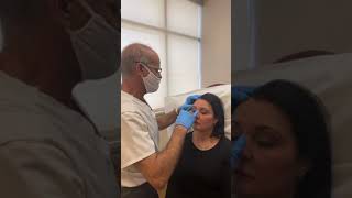 Xeomin Injection for Brow Lift Lip Flip and Tight Jaw [upl. by Sarkaria]