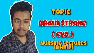 Cerebrovascular Accident CVA Brain Stroke  Nursing Lectures in Hindi MSN 2 [upl. by Kohler]