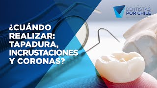 🤔¿TAPADURA DENTAL INCRUSTACIÓN o CORONA❓❓  Cuando y CÓMO elegir la correcta [upl. by Etselec]