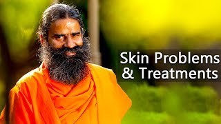 Skin Problems amp Treatments  Swami Ramdev [upl. by Jangro]