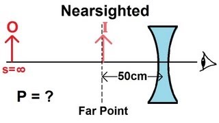 Myopia  nearsightedness  and Hyperopia  farsightedness  human eyes [upl. by Sirrep]