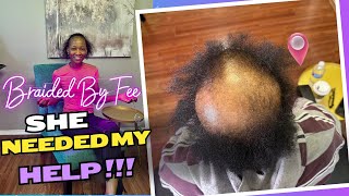 How to Alopecia 5 min video First Time Doing Box Braids On Client With Alopecia Can It Be Done [upl. by Nylegna]