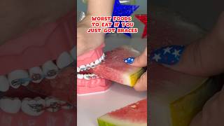 5 FOODS to AVOID if you just got BRACES put ON braces foodasmr satisfying [upl. by Hogle811]