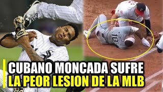 CUBANO SUFRE LA PEOR LESION DE MLB Y PIERDE SU CARRERA CASI yoan moncada [upl. by Iralav]