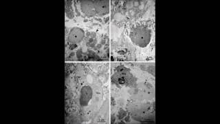 Occurrence of eosinophil extracellular trap cell death in COPD – Video abstract 115969 [upl. by Eladnek]