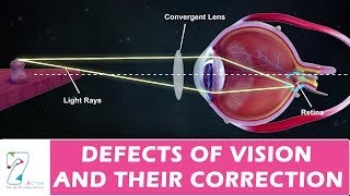 HYPERMETROPIA  PRESBYOPIA  POWER OF A LENS  HUMAN EYE AND COLOURFUL WORLD  10TH CLASS  PHYSICAL [upl. by Naesad]