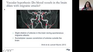 What Is Migraine and What Causes It by Dr Maggie Waung MD PhD [upl. by Euqirrne]